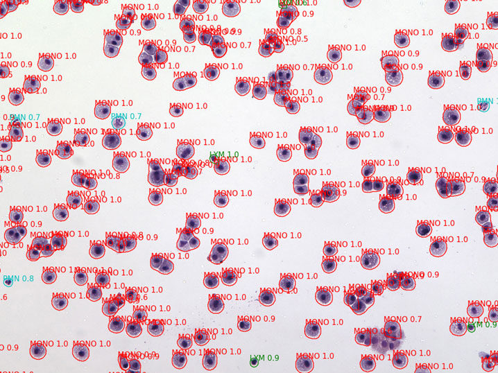 cell detection and categorization results alt text